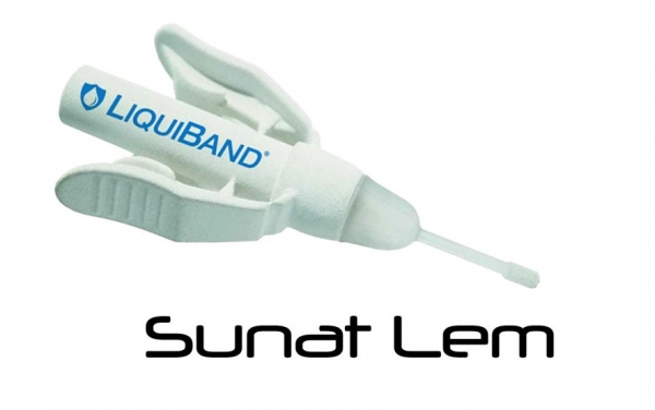 sunat123.com - Apa saja persiapan Sunat Pada Anak Berkebutuhan Khusus?