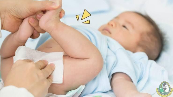 sunat123 - Fimosis Pada Bayi Harus Segera Disunat? Ini Penjelasannya