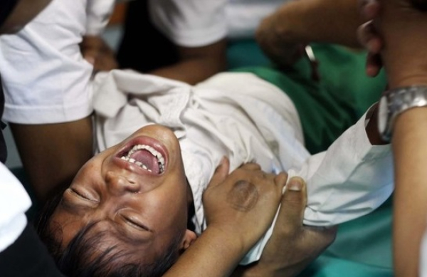 Sunat 123 - Gagal Sunat, Penyebab dan Cara Mengatasinya